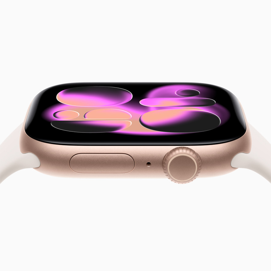 Apple Watch Series 11 Resim 5